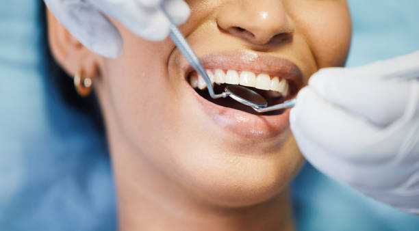 Best Broken or Cracked Tooth Emergency Dentist in Smithville, MO