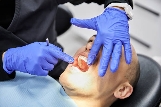 Best Emergency Dental Extractions in Smithville, MO